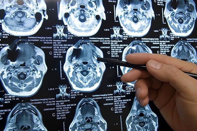 乐动体育 LD体育几千万一台的核磁共振仪为何号称永不关机?电费由患者承担吗?(图3) 乐动体育 LD体育几千万一台的核磁共振仪为何号称永不关机?电费由患者承担吗?(图3)