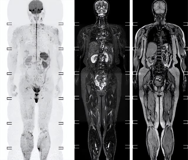 乐动体育 LD体育几千万一台的核磁共振仪为何号称永不关机?电费由患者承担吗?(图9) 乐动体育 LD体育几千万一台的核磁共振仪为何号称永不关机?电费由患者承担吗?(图9)